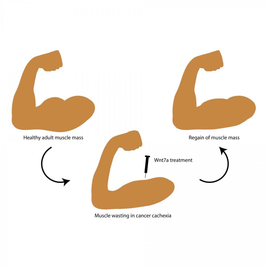 Does Muscle Mass Help With Cancer