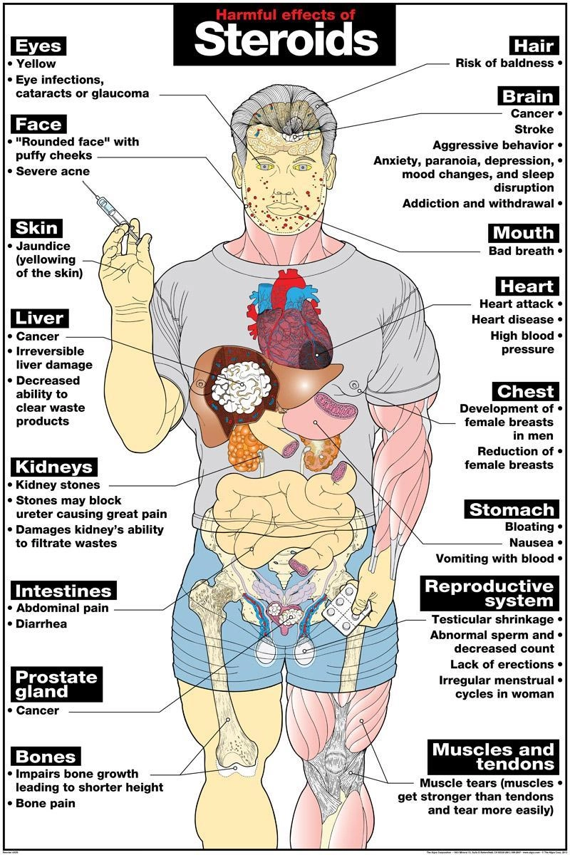 Risks and Side Effects of Steroids